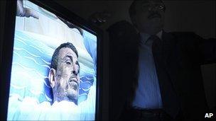 A surgeon (seen in shadow) shows video of Abdu Abdel-Monaim at a Cairo hospital, 17 January