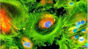 Kidney cancer cells