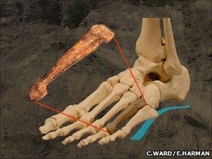 Bone position in foot (Carol Ward and Elizabeth Harman)