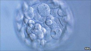 A human embryo at 4 days old