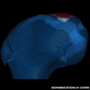 Bone repaired with bioprinting (Biofabrication journal/D Cohen)