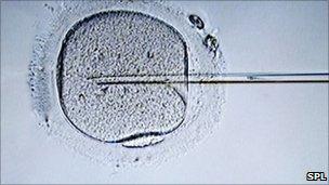 IVF