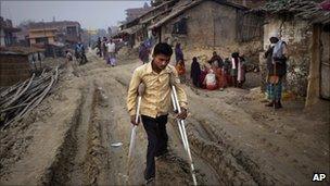 A Polio victim in India