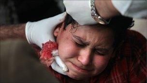 A young boy being treated by a doctor in Egypt