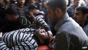 An injured Palestinian man is wheeled into the al-Shifa hospital in Gaza City following an Israeli military strike in Gaza City on March 22, 2011