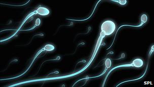 Sperm