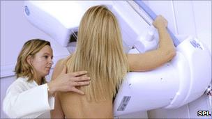 Woman having mammogram