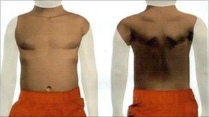 Torso image