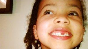 Girl with tooth missing