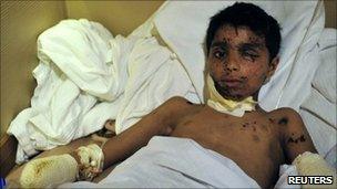 A wounded boy lies on a mattress on a Turkish humanitarian ship (3 April 2011)