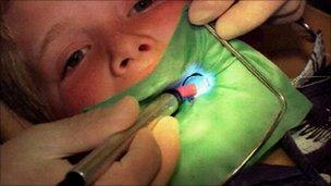 child in dentist chair
