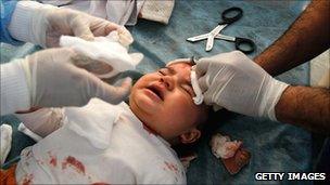 A baby being treated for shrapnel wounds in Misrata, 18 April 2010