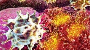 T-cells attacking a tumour, artwork