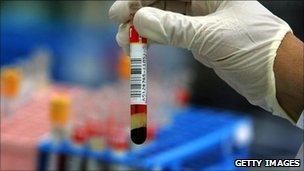 Blood sample (file image)