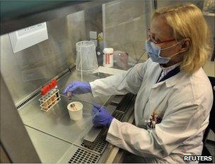 An employee displays a stool sample with EHEC bacteria at the UKE laboratory in Hamburg, 24 May