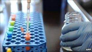 An employee of the veterinarian institute in Hanover, central Germany, prepares a quick test for the identification of EHEC (1 June 2011)