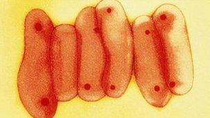 Tuberculosis bacteria