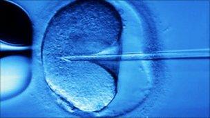 IVF treatment