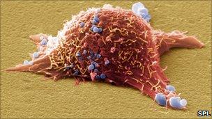 Skin cancer cell