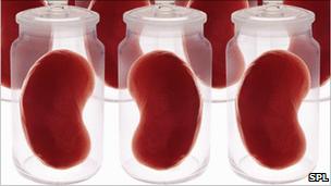 Kidneys in jars