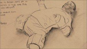 A sketch of an injured soldier who had his arms and legs amputated