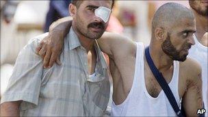 Wounded Syrian refugees help each other as they head toward an ambulance in a camp in the Turkish town of Yayladagi on 22 June 2011