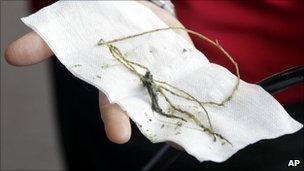 A veterinary nurse holds debris removed from the stomach of the emperor penguin (27 June 2011)