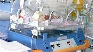 Premature baby at Buscot Ward