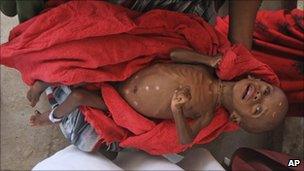 Malnourished child from southern Somalia is cared for at a camp in Mogadishu, Somalia, on 23 July 2011