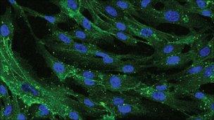 Bone marrow stem cells