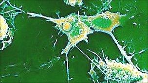 In MS, the immune system attacks myelin in nerve fibres