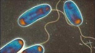 Legionella bacteria