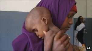 A malnourished child from southern Somalia is carried by his mother at a hospital in Mogadishu