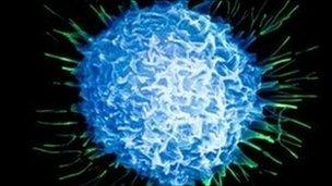 Prostate cancer cell