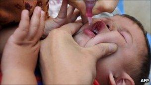 A toddler receives a polio vaccine. File photo