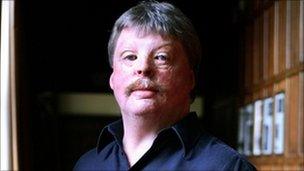 Simon Weston