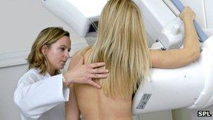 Mammogram