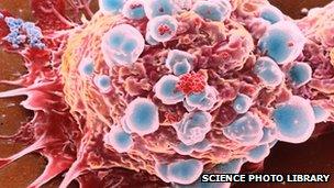 Breast cancer cell