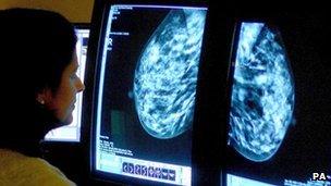 A consultant analysing a mammogram as she checks for breast cancer