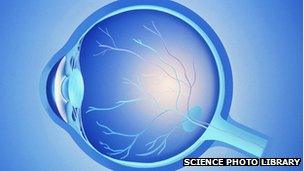 Artwork of a section through a healthy human eyeball