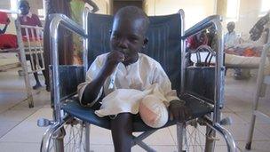 Stephen Gatwech who lost his leg after stepping on a mine in Unity State