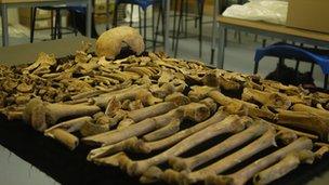 Selection of human bones from Gloucester Museum