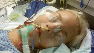 Kirstie after the transplant operation