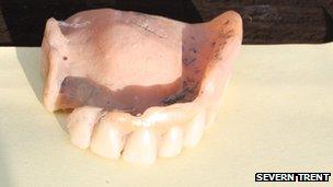 False teeth recovered by Severn Trent. Photo: Severn Trent