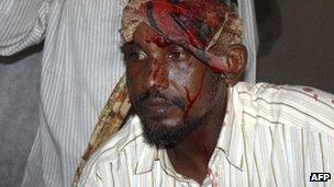 A member of Somalia parliament injured in a brawl on Wednesday 4 January