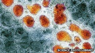 H5N1 avian influenza virus particles