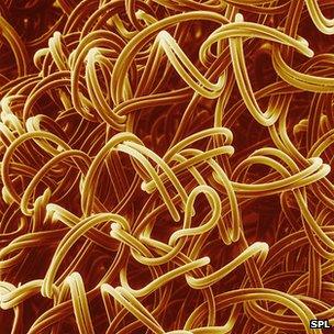 Scanning microscope image of nylon fibres