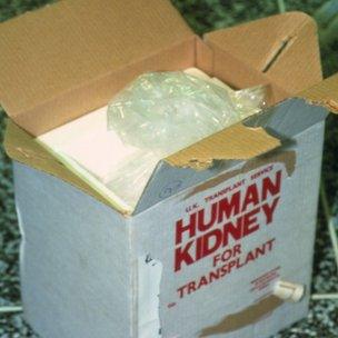 Kidney transplant box