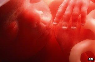 A five-month-old foetus in the womb