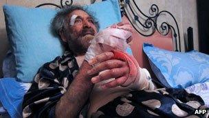 Ali Farzat after he was attacked